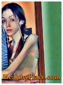 I detta foto av självskada gör en flicka med anorexi också självskada genom att slå och blåmärka delar av kroppen