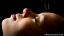 Användning och effektivitet av akupunktur